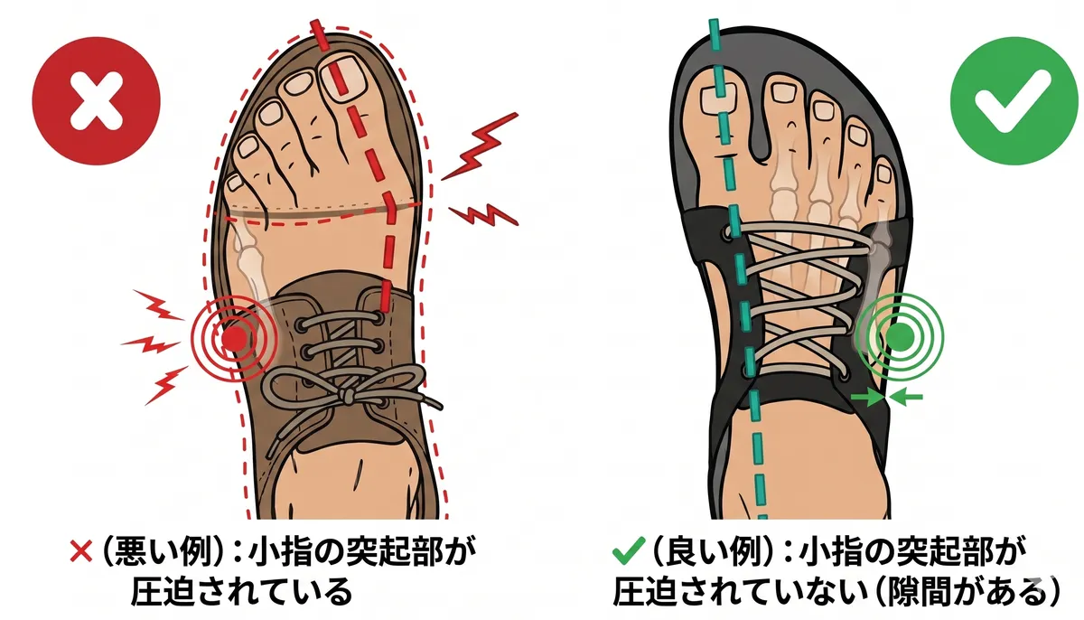 靴の圧迫の悪い例と良い例